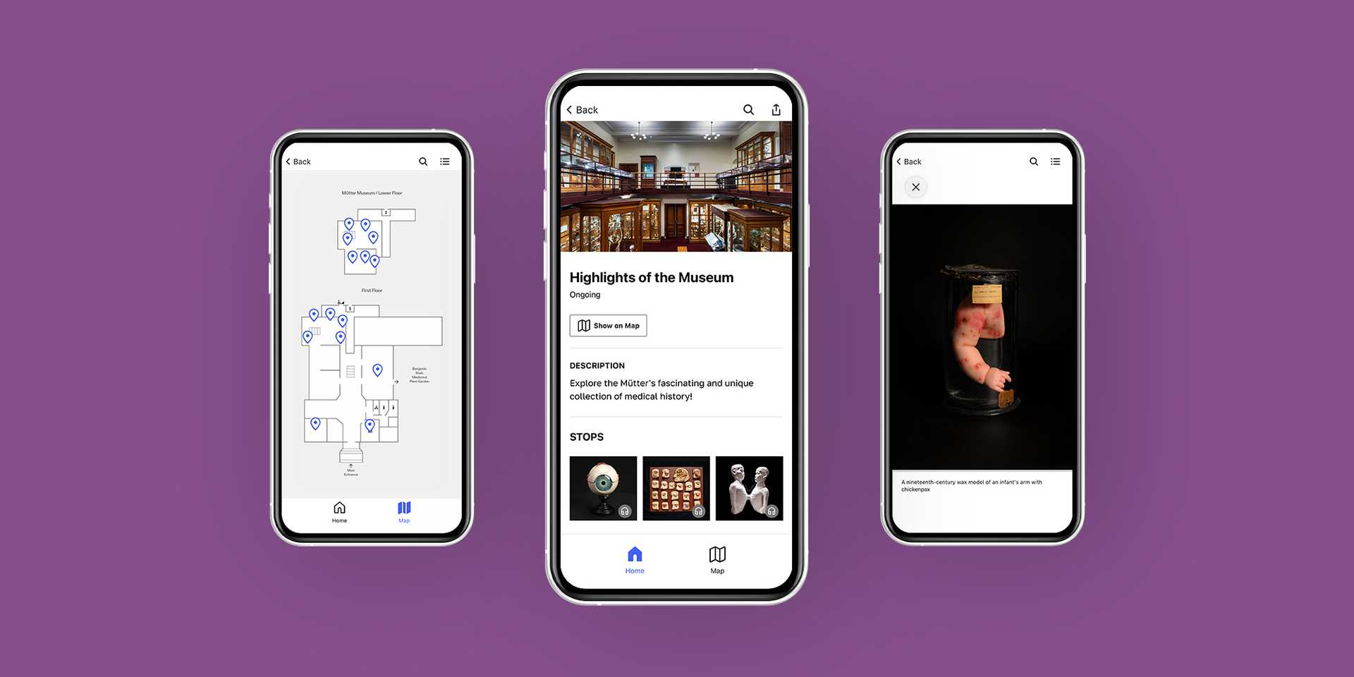 Smart phone screen showing a photo of the Mütter Museum with the text "Highlights of the Museum" against a purple background