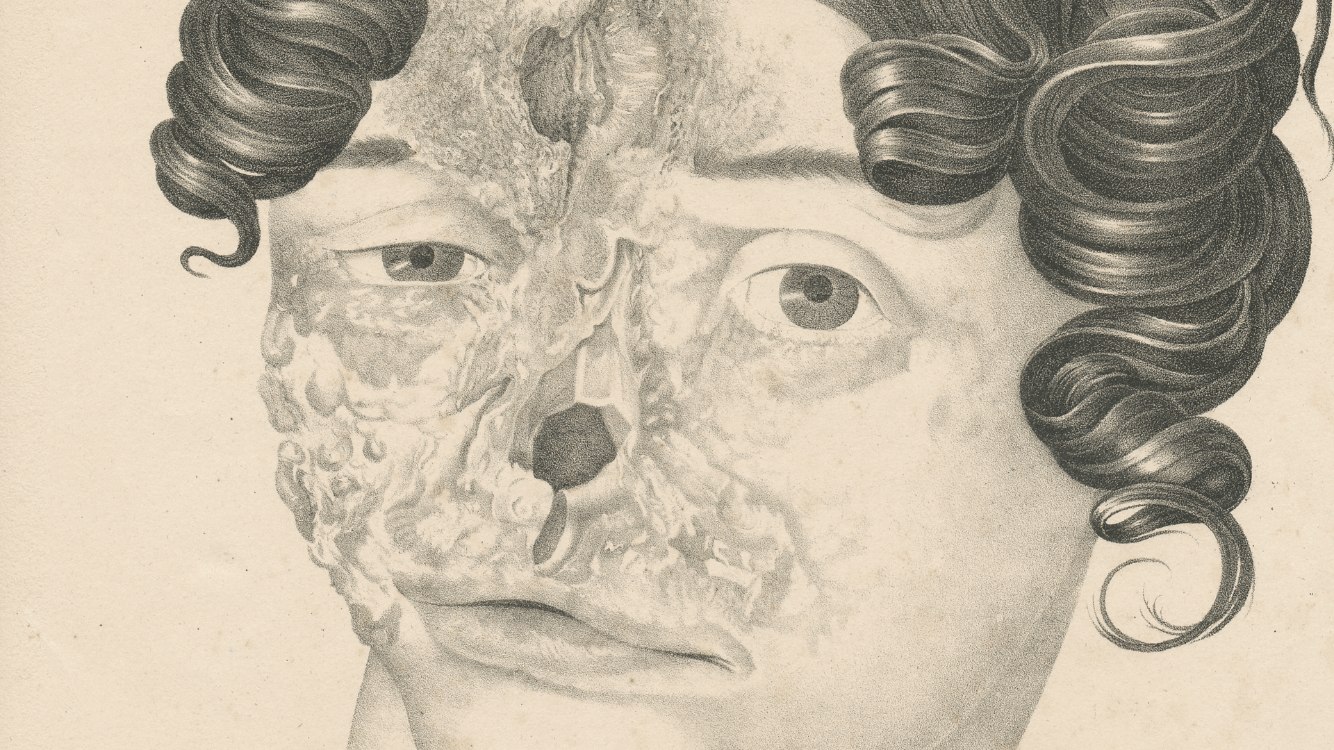 Sketch of woman with significant facial damage including to her nose