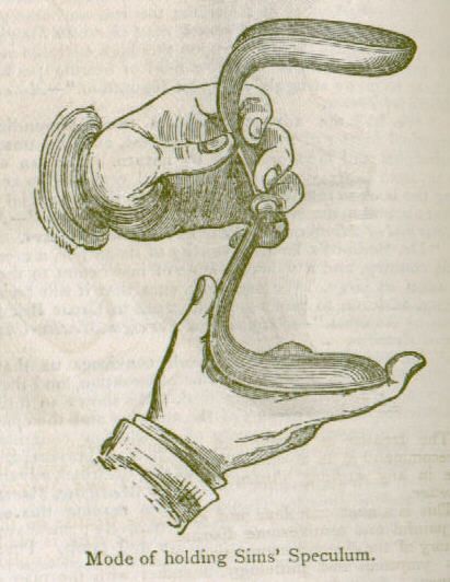 Illustration of two hands holding a vaginal speculum. A caption reads, "Mode of holding Sims' speculum." 
