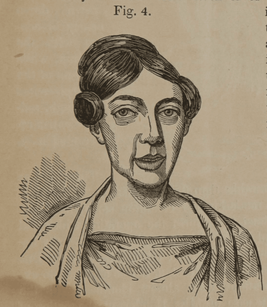 Illustration of woman with hair pinned up and without any evidence of scarring on her face
